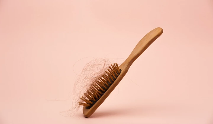 Perte de cheveux table des matières Perte de cheveux table des matières