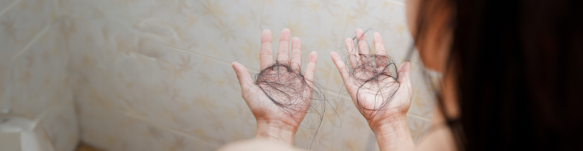 Perte de cheveux chez la femme