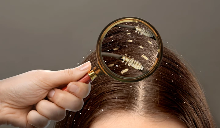 Hoe ziet een luis er nu eigenlijk uit? Hoe ziet een luis er nu eigenlijk uit?