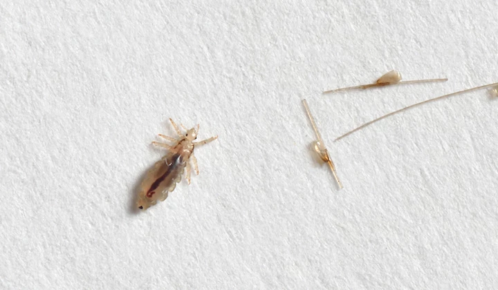 Zorg dat je luizen kan herkennen bij jezelf. Zorg dat je luizen kan herkennen bij jezelf.