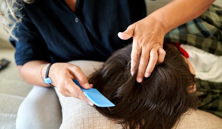 Verwar neten niet met schilfers! Verwar neten niet met schilfers!