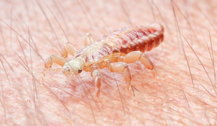 Vous avez trouvé des poux ?