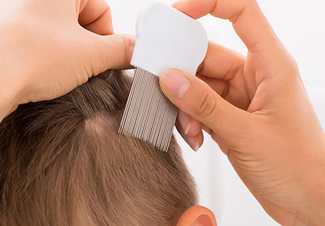 Lisez ici comment détecter les poux.