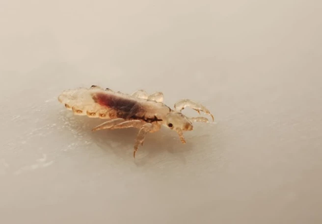 Hoe ziet een luis eruit? Weet waar je naar op zoek bent!