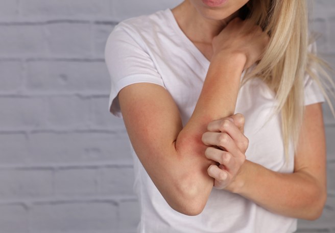 Pour tout savoir sur l'eczéma, cliquez ici.