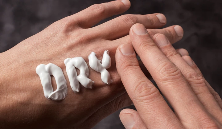 Les personnes ayant la peau sèche sont plus susceptibles de souffrir d'eczéma.