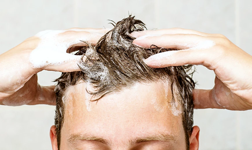 Que faire en cas de cuir chevelu gras? Que faire en cas de cuir chevelu gras?